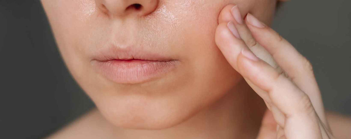 Visage avec une peau grasse